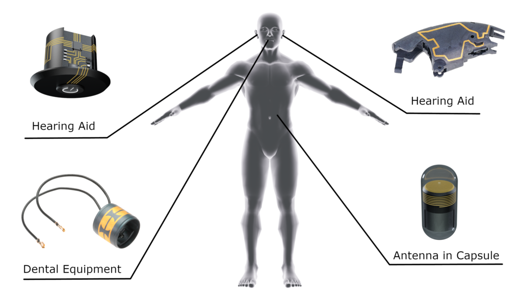 Implantable 3D-MID parts